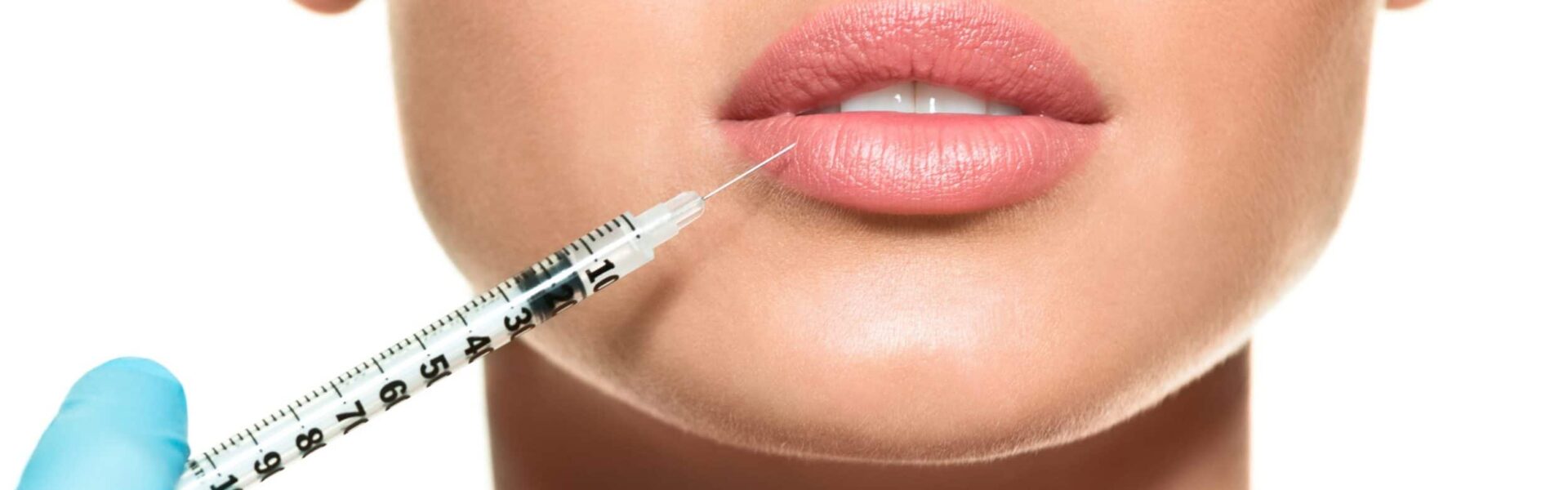 dysport lips