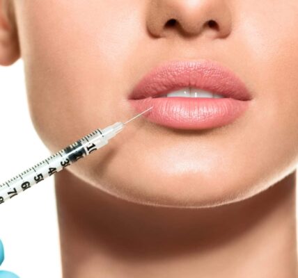dysport lips